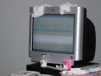 4 one very large contraction showing on screen